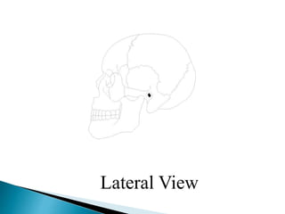 Lateral View
 