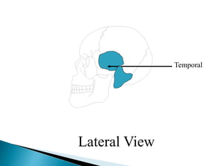 Temporal
Lateral View
 