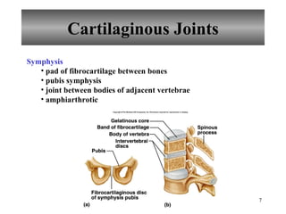 Cartilaginous Joints Symphysis pad of fibrocartilage between bones pubis symphysis joint between bodies of adjacent vertebrae amphiarthrotic 