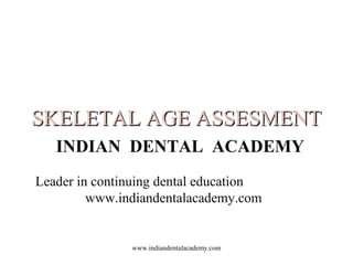 SKELETAL AGE ASSESMENT
INDIAN DENTAL ACADEMY
Leader in continuing dental education
www.indiandentalacademy.com

www.indiandentalacademy.com

 