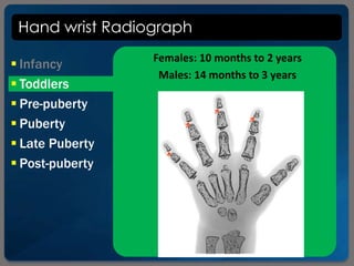 Hand wrist Radiograph
 Infancy
 Toddlers
 Pre-puberty
 Puberty
 Late Puberty
 Post-puberty
Females: 10 months to 2 years
Males: 14 months to 3 years
 