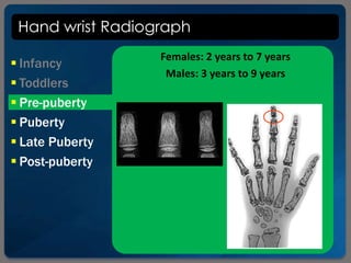 Hand wrist Radiograph
 Infancy
 Toddlers
 Pre-puberty
 Puberty
 Late Puberty
 Post-puberty
Females: 2 years to 7 years
Males: 3 years to 9 years
 