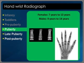 Hand wrist Radiograph
 Infancy
 Toddlers
 Pre-puberty
 Puberty
 Late Puberty
 Post-puberty
Females: 7 years to 13 years
Males: 9 years to 14 years
 