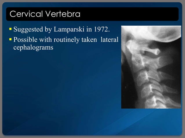 Skeletal age assessment | PPTX