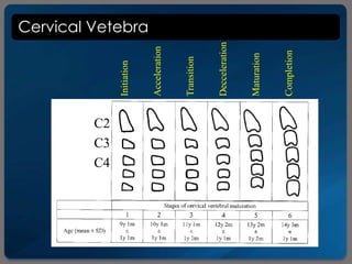Cervical Vetebra
Initiation
Acceleration
Transition
Decceleration
Maturation
Completion
C2
C3
C4
 