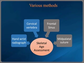 Skeletal
Age
Assessment
Hand wrist
radiograph
Cervical
vertebra
Frontal
Sinus
Midpalatal
suture
 
