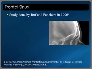 Frontal Sinus
 Study done by Ruf and Pancherz in 19961
1- Sabine Ruf, Hans Pancherz. Frontal Sinus Development as an indicator for somatic
maturity at puberty?, AJODO 1996;110:476-82
 