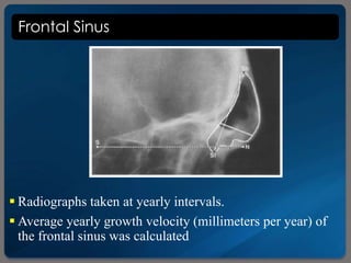 Frontal Sinus
 Radiographs taken at yearly intervals.
 Average yearly growth velocity (millimeters per year) of
the frontal sinus was calculated
 