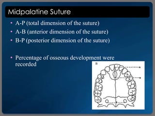 Midpalatine Suture
• A-P (total dimension of the suture)
• A-B (anterior dimension of the suture)
• B-P (posterior dimension of the suture)
• Percentage of osseous development were
recorded
 