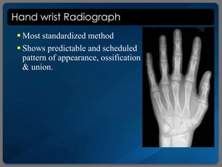 Hand wrist Radiograph
 Most standardized method
 Shows predictable and scheduled
pattern of appearance, ossification
& union.
 