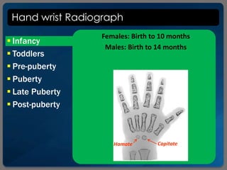Hand wrist Radiograph
 Infancy
 Toddlers
 Pre-puberty
 Puberty
 Late Puberty
 Post-puberty
Females: Birth to 10 months
Males: Birth to 14 months
Hamate Capitate
 