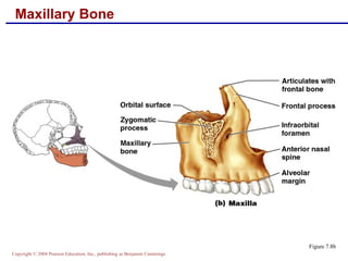 Netter Maxilla Skeletal anatomy part 1 | PPT