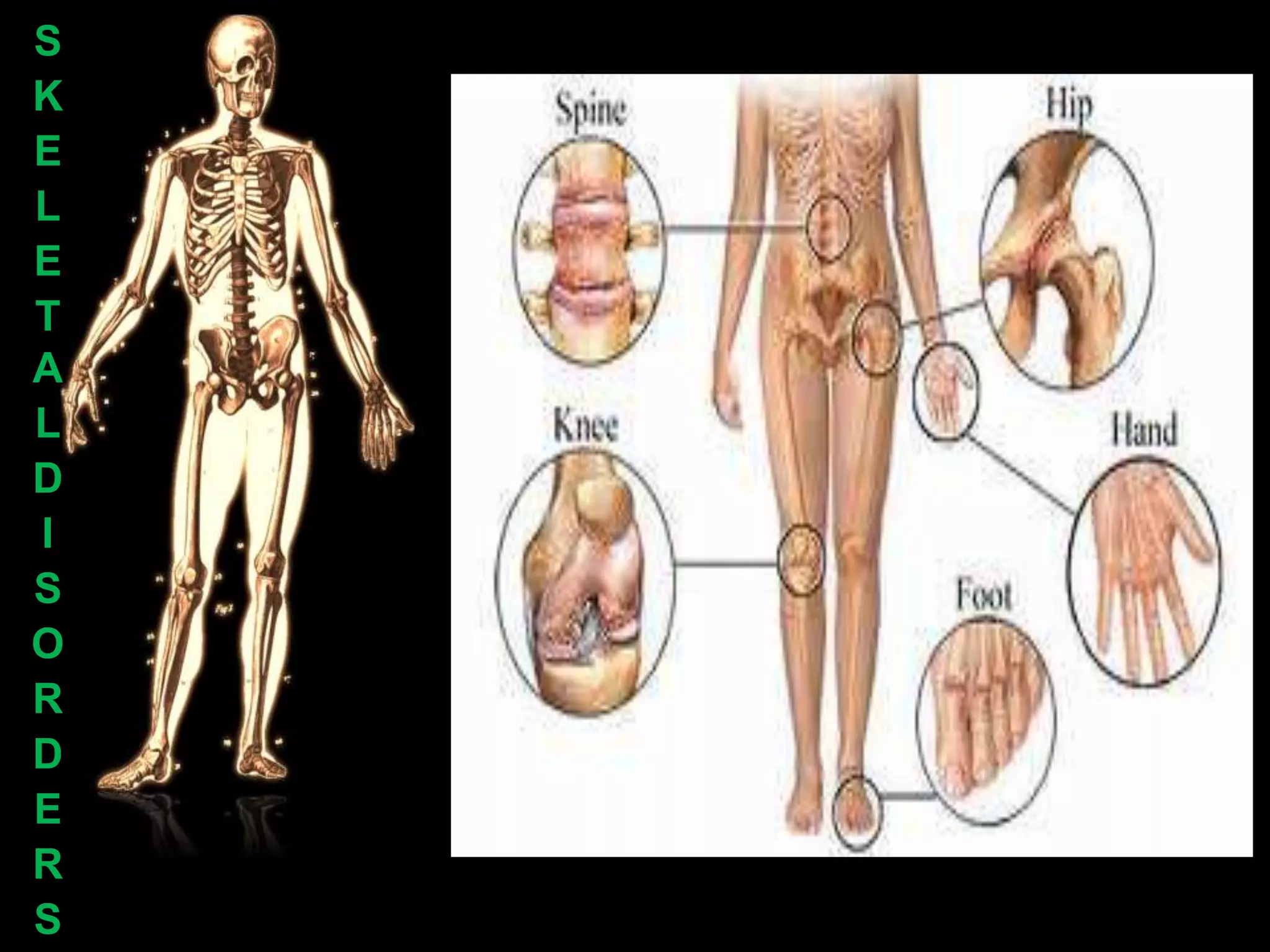 S
K
E
L
E
T
A
L
D
I
S
O
R
D
E
R
S
 