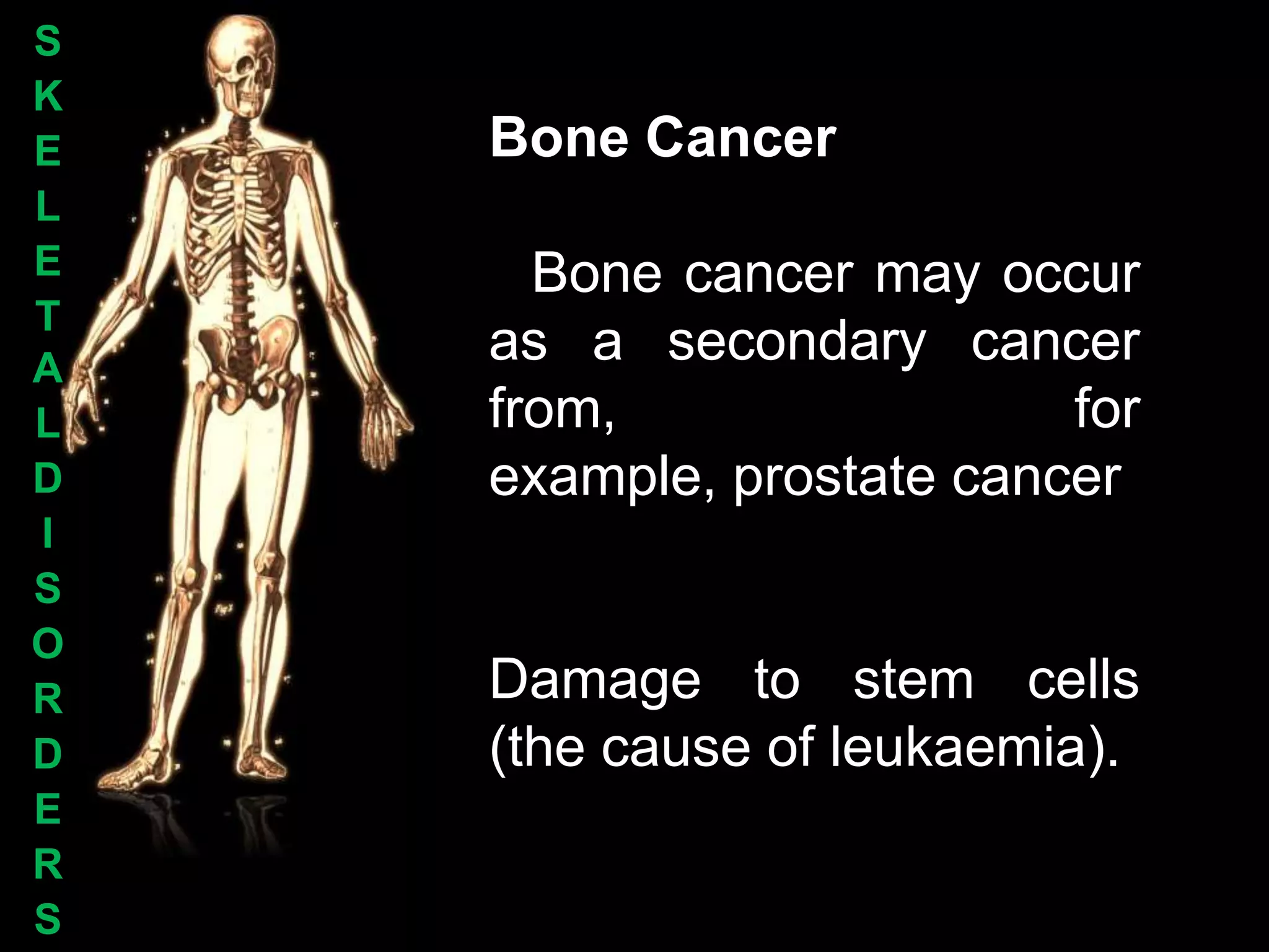 S
K
E   Bone Cancer
L
E     Bone cancer may occur
T
A
    as a secondary cancer
L   from,                 for
D   example, prostate cancer
I
S
O
R   Damage to stem cells
D   (the cause of leukaemia).
E
R
S
 