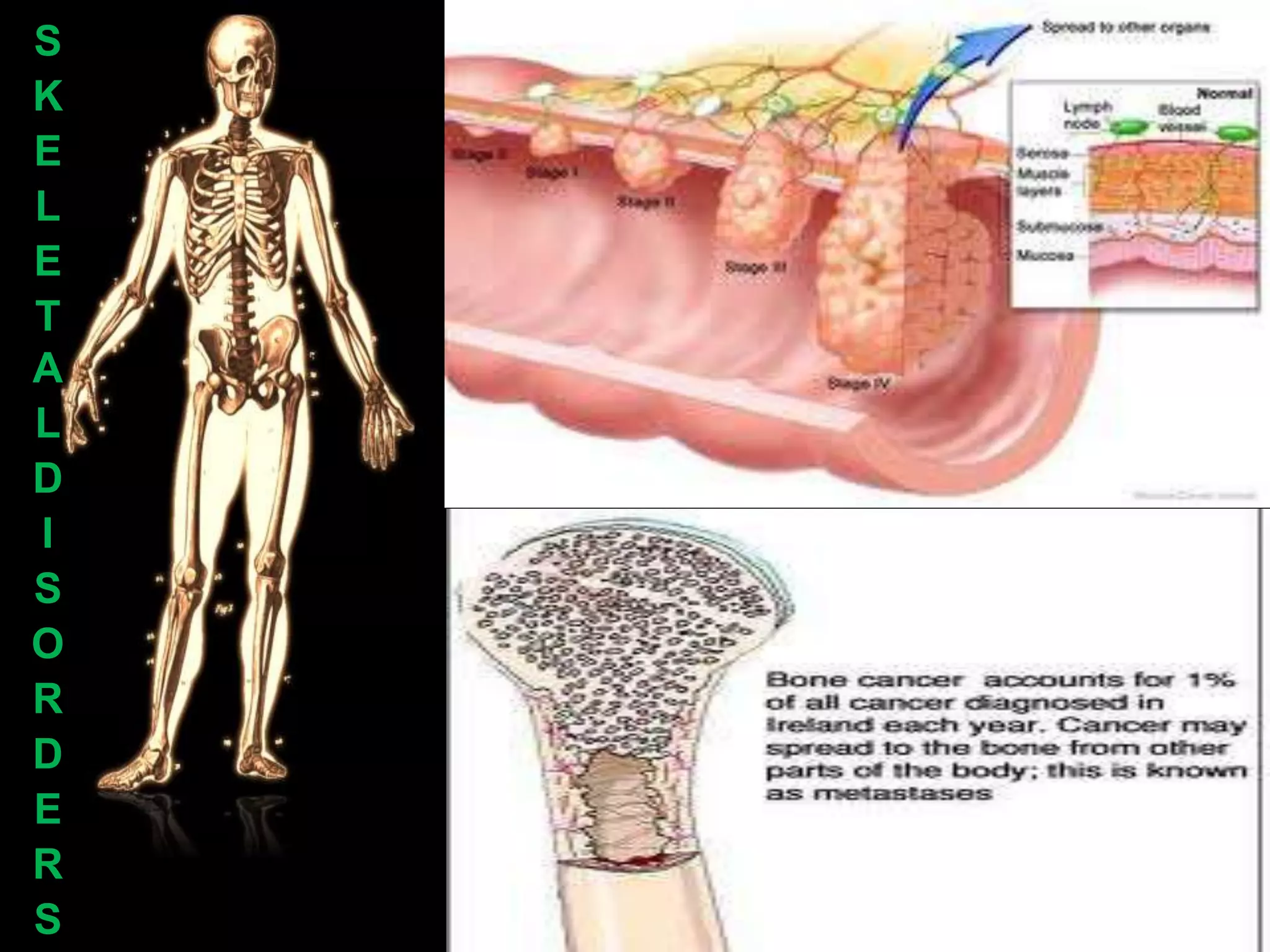 S
K
E
L
E
T
A
L
D
I
S
O
R
D
E
R
S
 