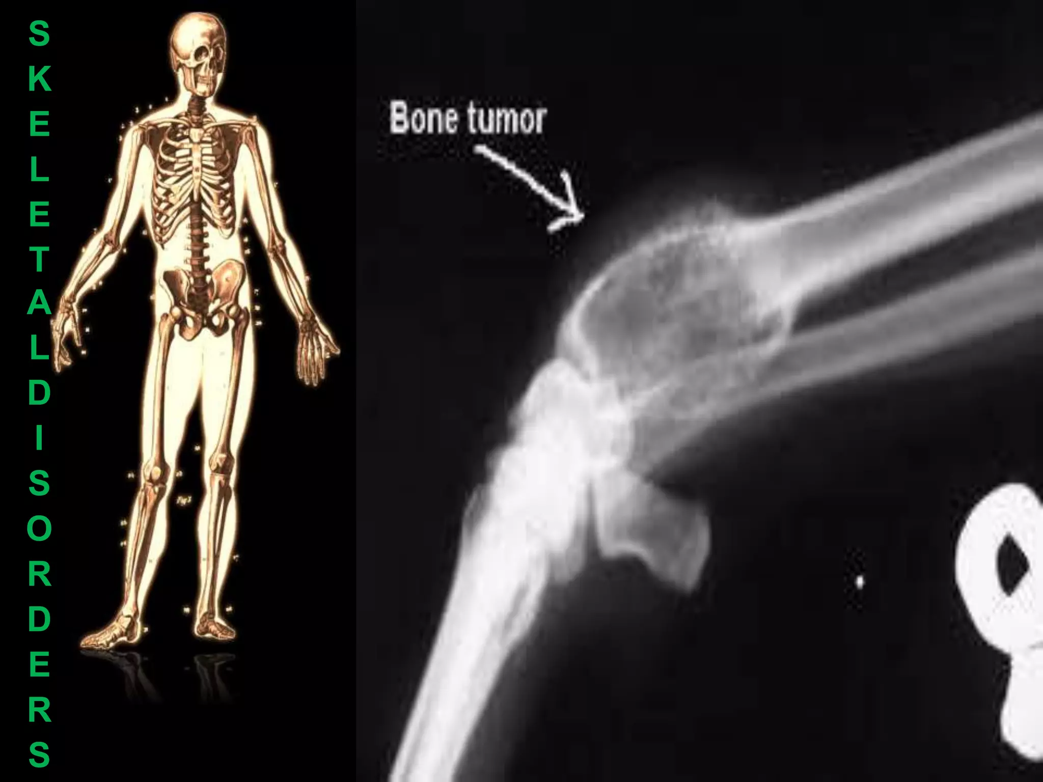 S
K
E
L
E
T
A
L
D
I
S
O
R
D
E
R
S
 