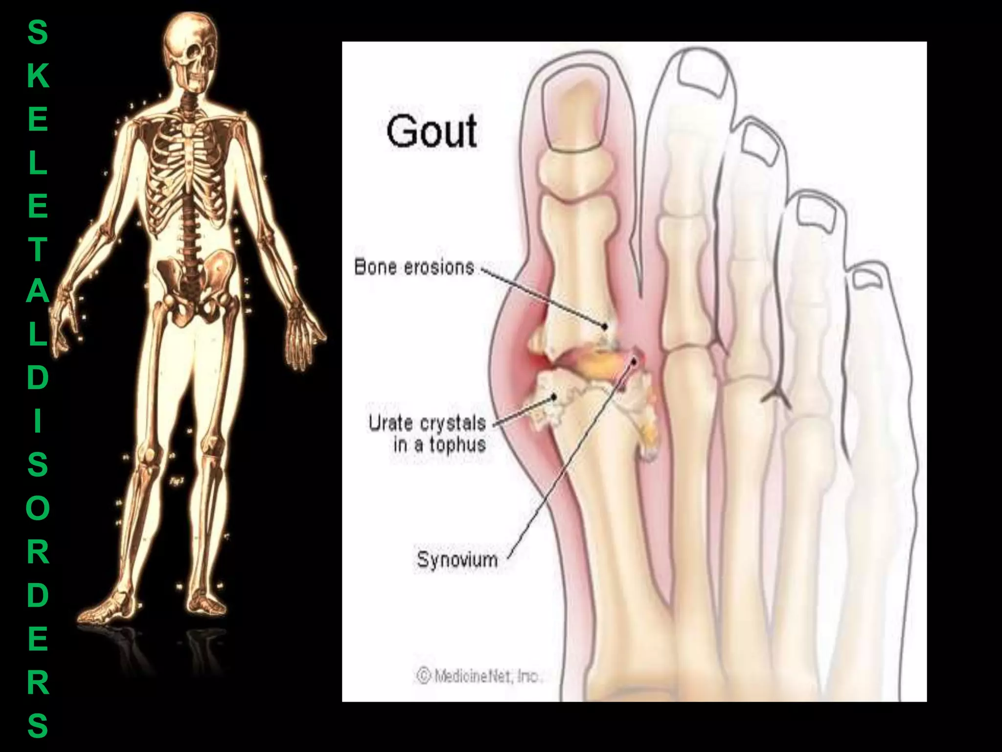 S
K
E
L
E
T
A
L
D
I
S
O
R
D
E
R
S
 