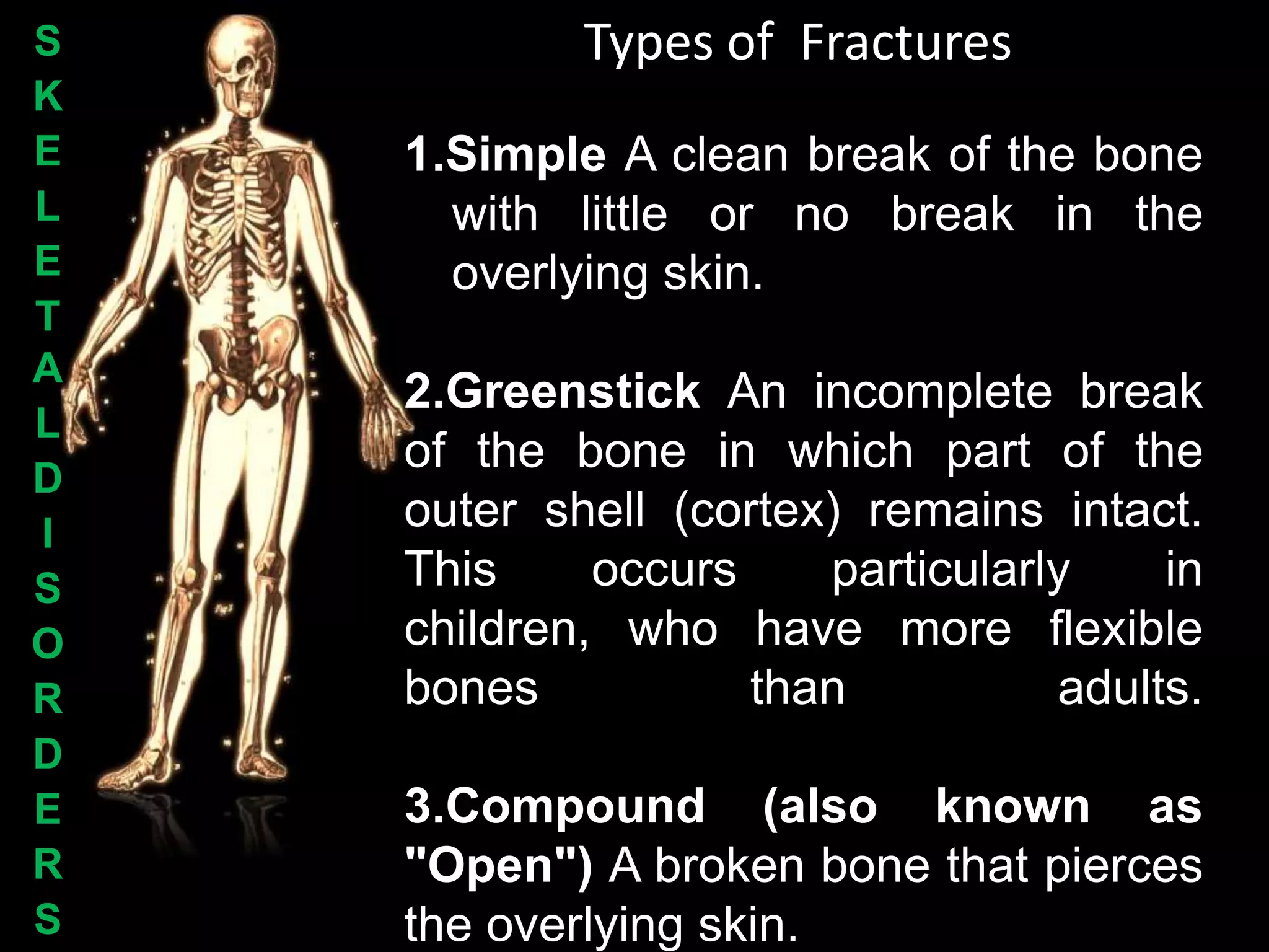 S           Types of Fractures
K
E   1.Simple A clean break of the bone
L     with little or no break in the
E     overlying skin.
T
A
    2.Greenstick An incomplete break
L
    of the bone in which part of the
D
I
    outer shell (cortex) remains intact.
S   This     occurs    particularly    in
O   children, who have more flexible
R   bones           than          adults.
D
E   3.Compound (also known as
R   "Open") A broken bone that pierces
S   the overlying skin.
 