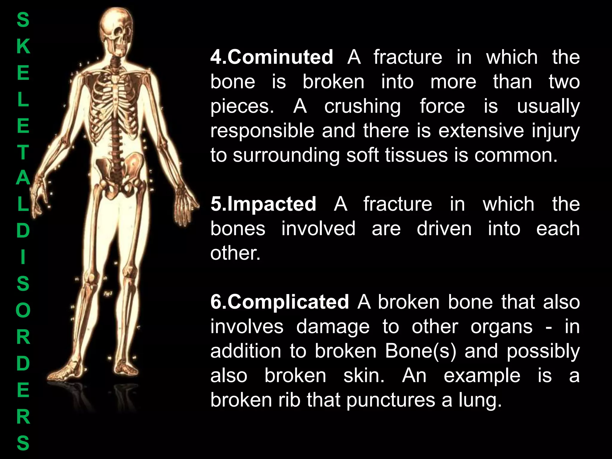 S
K
    4.Cominuted A fracture in which the
E   bone is broken into more than two
L   pieces. A crushing force is usually
E   responsible and there is extensive injury
T   to surrounding soft tissues is common.
A
L   5.Impacted A fracture in which the
D   bones involved are driven into each
I   other.
S
O   6.Complicated A broken bone that also
    involves damage to other organs - in
R
    addition to broken Bone(s) and possibly
D
    also broken skin. An example is a
E   broken rib that punctures a lung.
R
S
 