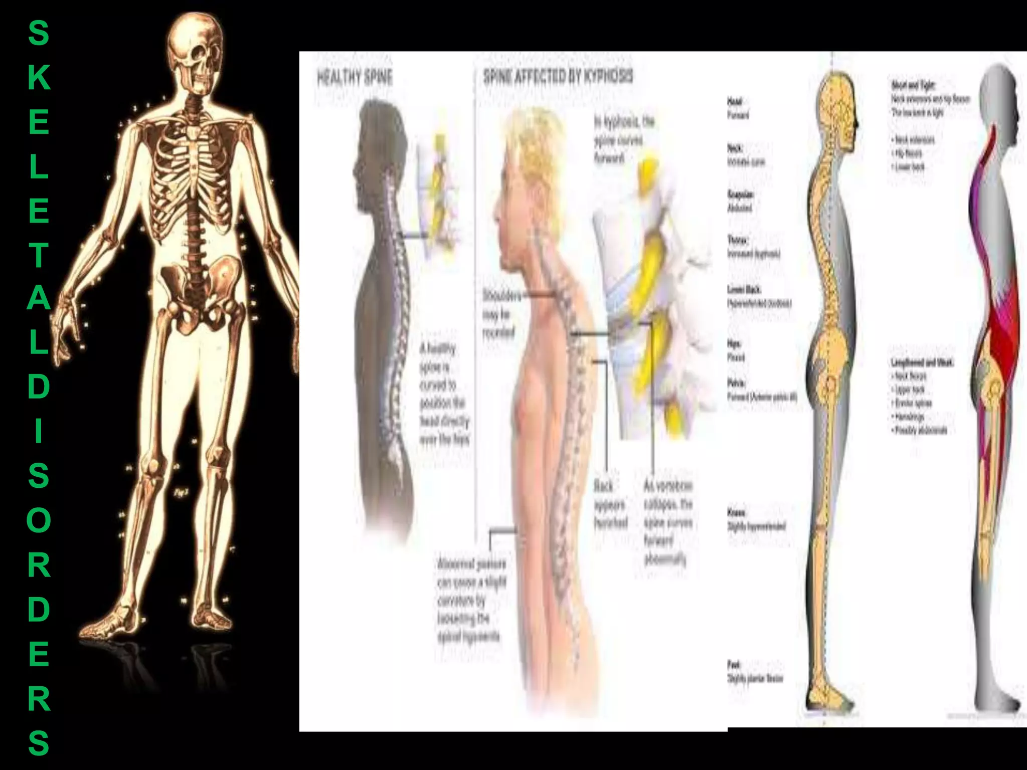 S
K
E
L
E
T
A
L
D
I
S
O
R
D
E
R
S
 