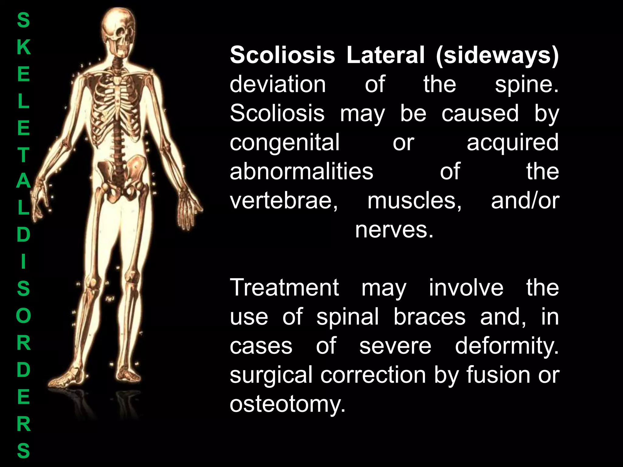 S
K   Scoliosis Lateral (sideways)
E
    deviation   of    the    spine.
L
    Scoliosis may be caused by
E
T
    congenital     or      acquired
A   abnormalities       of      the
L   vertebrae, muscles, and/or
D              nerves.
I
S   Treatment may involve the
O   use of spinal braces and, in
R   cases of severe deformity.
D   surgical correction by fusion or
E   osteotomy.
R
S
 