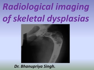 Radiological imaging
of skeletal dysplasias
Dr. Bhanupriya Singh.
 
