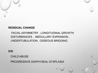 RESIDUAL CHANGE
FACIAL ASYMMETRY , LONGITUDINAL GROWTH
DISTURBANCES , MEDULLARY EXPANSION ,
UNDERTUBULATION , OSSEOUS BRIDGING
D/D
CHILD ABUSE
PROGRESSIVE DIAPHYSEAL DYSPLASIA
 