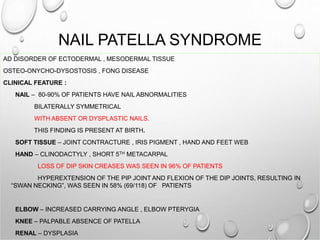 NAIL PATELLA SYNDROME
AD DISORDER OF ECTODERMAL , MESODERMAL TISSUE
OSTEO-ONYCHO-DYSOSTOSIS , FONG DISEASE
CLINICAL FEATURE :
NAIL – 80-90% OF PATIENTS HAVE NAIL ABNORMALITIES
BILATERALLY SYMMETRICAL
WITH ABSENT OR DYSPLASTIC NAILS.
THIS FINDING IS PRESENT AT BIRTH.
SOFT TISSUE – JOINT CONTRACTURE , IRIS PIGMENT , HAND AND FEET WEB
HAND – CLINODACTYLY , SHORT 5TH METACARPAL
LOSS OF DIP SKIN CREASES WAS SEEN IN 96% OF PATIENTS
HYPEREXTENSION OF THE PIP JOINT AND FLEXION OF THE DIP JOINTS, RESULTING IN
“SWAN NECKING”, WAS SEEN IN 58% (69/118) OF PATIENTS
ELBOW – INCREASED CARRYING ANGLE , ELBOW PTERYGIA
KNEE – PALPABLE ABSENCE OF PATELLA
RENAL – DYSPLASIA
 