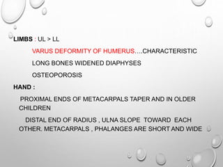 LIMBS : UL > LL
VARUS DEFORMITY OF HUMERUS….CHARACTERISTIC
LONG BONES WIDENED DIAPHYSES
OSTEOPOROSIS
HAND :
PROXIMAL ENDS OF METACARPALS TAPER AND IN OLDER
CHILDREN
DISTAL END OF RADIUS , ULNA SLOPE TOWARD EACH
OTHER. METACARPALS , PHALANGES ARE SHORT AND WIDE
 