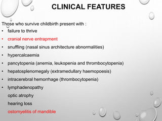 Those who survive childbirth present with :
• failure to thrive
• cranial nerve entrapment
• snuffling (nasal sinus architecture abnormalities)
• hypercalcaemia
• pancytopenia (anemia, leukopenia and thrombocytopenia)
• hepatosplenomegaly (extramedullary haemopoesis)
• intracerebral hemorrhage (thrombocytopenia)
• lymphadenopathy
optic atrophy
hearing loss
ostomyelitis of mandible
CLINICAL FEATURES
 