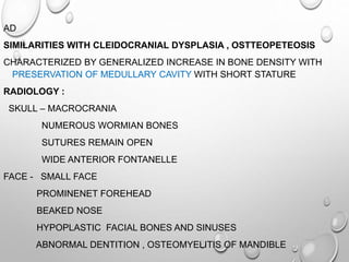 AD
SIMILARITIES WITH CLEIDOCRANIAL DYSPLASIA , OSTTEOPETEOSIS
CHARACTERIZED BY GENERALIZED INCREASE IN BONE DENSITY WITH
PRESERVATION OF MEDULLARY CAVITY WITH SHORT STATURE
RADIOLOGY :
SKULL – MACROCRANIA
NUMEROUS WORMIAN BONES
SUTURES REMAIN OPEN
WIDE ANTERIOR FONTANELLE
FACE - SMALL FACE
PROMINENET FOREHEAD
BEAKED NOSE
HYPOPLASTIC FACIAL BONES AND SINUSES
ABNORMAL DENTITION , OSTEOMYELITIS OF MANDIBLE
 
