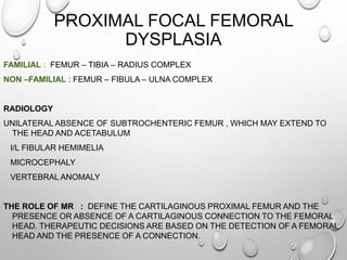 PROXIMAL FOCAL FEMORAL
DYSPLASIA
FAMILIAL : FEMUR – TIBIA – RADIUS COMPLEX
NON –FAMILIAL : FEMUR – FIBULA – ULNA COMPLEX
RADIOLOGY
UNILATERAL ABSENCE OF SUBTROCHENTERIC FEMUR , WHICH MAY EXTEND TO
THE HEAD AND ACETABULUM
I/L FIBULAR HEMIMELIA
MICROCEPHALY
VERTEBRAL ANOMALY
THE ROLE OF MR : DEFINE THE CARTILAGINOUS PROXIMAL FEMUR AND THE
PRESENCE OR ABSENCE OF A CARTILAGINOUS CONNECTION TO THE FEMORAL
HEAD. THERAPEUTIC DECISIONS ARE BASED ON THE DETECTION OF A FEMORAL
HEAD AND THE PRESENCE OF A CONNECTION.
 