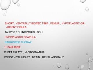 SHORT , VENTRALLY BOWED TIBIA , FEMUR , HYPOPLASTIC OR
ABSENT FIBULA
TALIPES EQUINOVARUS , CDH
HYPOPLASTIC SCAPULA
NARROWED THORAX
11 PAIR RIBS
CLEFT PALATE , MICROGNATHIA
CONGENITAL HEART , BRAIN , RENAL ANOMALY
 