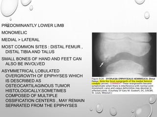 PREDOMINANTLY LOWER LIMB
MONOMELIC
MEDIAL > LATERAL
MOST COMMON SITES : DISTAL FEMUR ,
DISTAL TIBIA AND TALUS
SMALL BONES OF HAND AND FEET CAN
ALSO BE INVOLVED
ASYMMETRICAL LOBULATED
OVERGROWTH OF EPIPHYSES WHICH
IS DESCRIBED AS
OSTEOCARTILAGINOUS TUMOR
HISTOLOGICALLY.SOMETIMES
COMPOSED OF MULTIPLE
OSSIFICATION CENTERS , MAY REMAIN
SEPARATED FROM THE EPIPHYSES
 