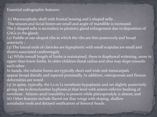 Essential radiographic features:
(1) Macrocephalic skull with frontal bossing and J-shaped sella .
The sinuses and facial bones are small and angle of mandible is increased.
The J-shaped sella is secondary to pituitary gland enlargement due to deposition of
GAGs in the gland;
(2) Paddle or oar-shaped ribs in which the ribs are thin posteriorly and broad
anteriorly ;
(3) The lateral ends of clavicles are hypoplastic with small scapulae are small and
there’s associated cardiomegaly
(4) While overall length of limbs is maintained, there is diaphyseal widening, more in
upper than lower limbs. In older children distal radius and ulna may slope towards
each other .
In hands, the tubular bones are typically short and wide and metacarpals
appear broad distally and tapered proximally. In addition, osteoporosis and flexion
deformities are noted.
(5) In spine, typically, the L2 or L1 vertebrais hypoplastic and set slightly posteriorly
giving rise to dorsolumbar kyphosis at that level with antero-inferior beaking of
vertebrae . Atlanto-axial instability is present while platyspondyly is absent; and
(6) Other features include flared out iliac wings with sloping, shallow
acetabular roofs and delayed ossification of femoral heads.
 