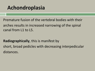 Achondroplasia
Premature fusion of the vertebral bodies with their
arches results in increased narrowing of the spinal
canal from L1 to L5.
Radiographically, this is manifest by
short, broad pedicles with decreasing interpedicular
distances.
 