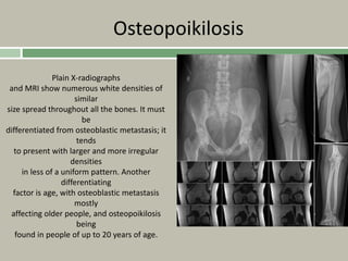 Osteopoikilosis
Plain X-radiographs
and MRI show numerous white densities of
similar
size spread throughout all the bones. It must
be
differentiated from osteoblastic metastasis; it
tends
to present with larger and more irregular
densities
in less of a uniform pattern. Another
differentiating
factor is age, with osteoblastic metastasis
mostly
affecting older people, and osteopoikilosis
being
found in people of up to 20 years of age.
 