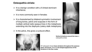 Osteopathia striata:
⮚ It is a benign condition with a X-linked dominant
inheritance.
⮚ It is more commonly seen in females
⮚ It is characterised by bilateral symmetric involvement
of long bones, pelvis and scapulae in the form of
multiple vertical radio opaque lines in the metaphysis
extending into the diaphysis (celery stalk metaphysis).
⮚ In the pelvis, this gives a sunburst effect.
Vertical striations around the knee in
osteopathia striata
AP radiograph shows linear striations throughout the osseous
pelvic structures. Note the fan-shaped appearance of the
striations in the iliac crests.
 