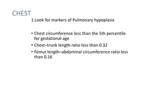 CHEST
1.Look for markers of Pulmonary hypoplasia
• Chest circumference less than the 5th percentile
for gestational age
• Chest–trunk length ratio less than 0.32
• Femur length–abdominal circumference ratio less
than 0.16
 