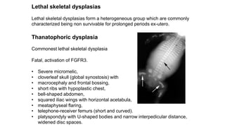 Lethal skeletal dysplasias
Lethal skeletal dysplasias form a heterogeneous group which are commonly
characterized being non survivable for prolonged periods ex-utero.
Thanatophoric dysplasia
Commonest lethal skeletal dysplasia
Fatal, activation of FGFR3.
• Severe micromelic,
• cloverleaf skull (global synostosis) with
• macrocephaly and frontal bossing,
• short ribs with hypoplastic chest,
• bell-shaped abdomen,
• squared iliac wings with horizontal acetabula,
• meataphyseal flaring,
• telephone-receiver femurs (short and curved).
• platyspondyly with U-shaped bodies and narrow interpedicular distance,
widened disc spaces.
 