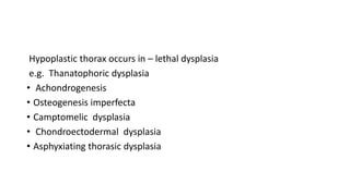 Hypoplastic thorax occurs in – lethal dysplasia
e.g. Thanatophoric dysplasia
• Achondrogenesis
• Osteogenesis imperfecta
• Camptomelic dysplasia
• Chondroectodermal dysplasia
• Asphyxiating thorasic dysplasia
 