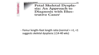 - Femur length–foot length ratio (normal = >1, <1
suggests skeletal dysplasia ) (14-40 wks)
 
