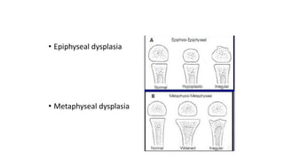 • Epiphyseal dysplasia
• Metaphyseal dysplasia
 