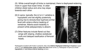 (5) While overall length of limbs is maintained, there is diaphyseal widening,
more in upper than lower limbs. In older
children distal radius and ulna may slope
towards each other.
(6) In spine, typically, the L2 or L1 vertebra is
hypoplastic and set slightly posteriorly
giving rise to dorsolumbar kyphosis at that
level with antero-inferior beaking of
vertebrae. Atlanto-axial instability is
present while platyspondyly is absent.
(7) Other features include flared out iliac
wings with sloping, shallow acetabular
roofs and delayed ossification of femoral
heads.
Radiographs of patient with Hurler’s syndrome. Also note relative diaphyseal widening in humerus (upper
arrow, C) and sloping lower ends or radius and ulna (lower arrow, C). Radiograph of spine (D) shows
hypoplastic L1 and antero-inferior beaking (arrows).
 