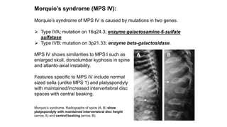 Morquio’s syndrome (MPS IV):
Morquio’s syndrome of MPS IV is caused by mutations in two genes.
⮚ Type IVA; mutation on 16q24.3; enzyme galactosamine-6-sulfate
sulfatase
⮚ Type IVB; mutation on 3p21.33; enzyme beta-galactosidase.
MPS IV shows similarities to MPS I such as
enlarged skull, dorsolumbar kyphosis in spine
and atlanto-axial instability.
Features specific to MPS IV include normal
sized sella (unlike MPS 1) and platyspondyly
with maintained/increased intervertebral disc
spaces with central beaking.
Morquio’s syndrome. Radiographs of spine (A, B) show
platyspondyly with maintained intervertebral disc height
(arrow, A) and central beaking (arrow, B).
 
