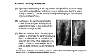 Essential radiological features:
(1) Symmetric shortening of all long bones, with proximal portions being
more affected and lower limb involvement being more than the upper
limb (rhizomelia). There’s relative flaring and splaying of metaphyses
with normal epiphyses.
(1) In children, the epiphysis is located
closer to metaphyses leading to an
apparent increase in the depth of the
articular cartilage space.
(3) The two limbs of the V of metaphysis
appear to embrace the epiphysis giving
rise to a ball and socket relationship/
chevron deformity. This appearance is
more common at lower end of femur
and tends to normalise with increasing
age;
Achondroplasia. Radiograph of lower limbs (A, B) shows bilateral rhizomelic shortening with metaphyseal
flaring (arrow, A) and chevron deformity in femur (arrow, B).
 