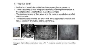 (6) The pelvic cavity
• is short and broad, also called as champagne-glass appearance.
• There’s squaring of iliac wings with some roundening of corners on a
frontal projection (elephant ear shaped iliac wings).
• The inferior margins of iliac wings and the roofs of acetabulum are flat
and horizontal.
• The sacrosciatic notches are small with an exaggerated sacral tilt and
large, anteriorly protruding sacral promontory.
Radiograph of pelvis (D) shows short and broad pelvis (*), horizontal acetabuli (arrow) and round iliac
wings.
 