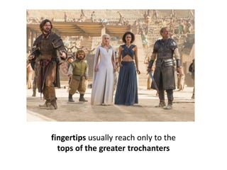 fingertips usually reach only to the
tops of the greater trochanters
 