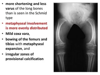 • more shortening and less
varus of the long bones
than is seen in the Schmid
type
• metaphyseal involvement
is more evenly distributed
• Mild coxa vara,
• bowing of the femurs and
tibias with metaphyseal
expansion, and
• irregular zones of
provisional calcification
 