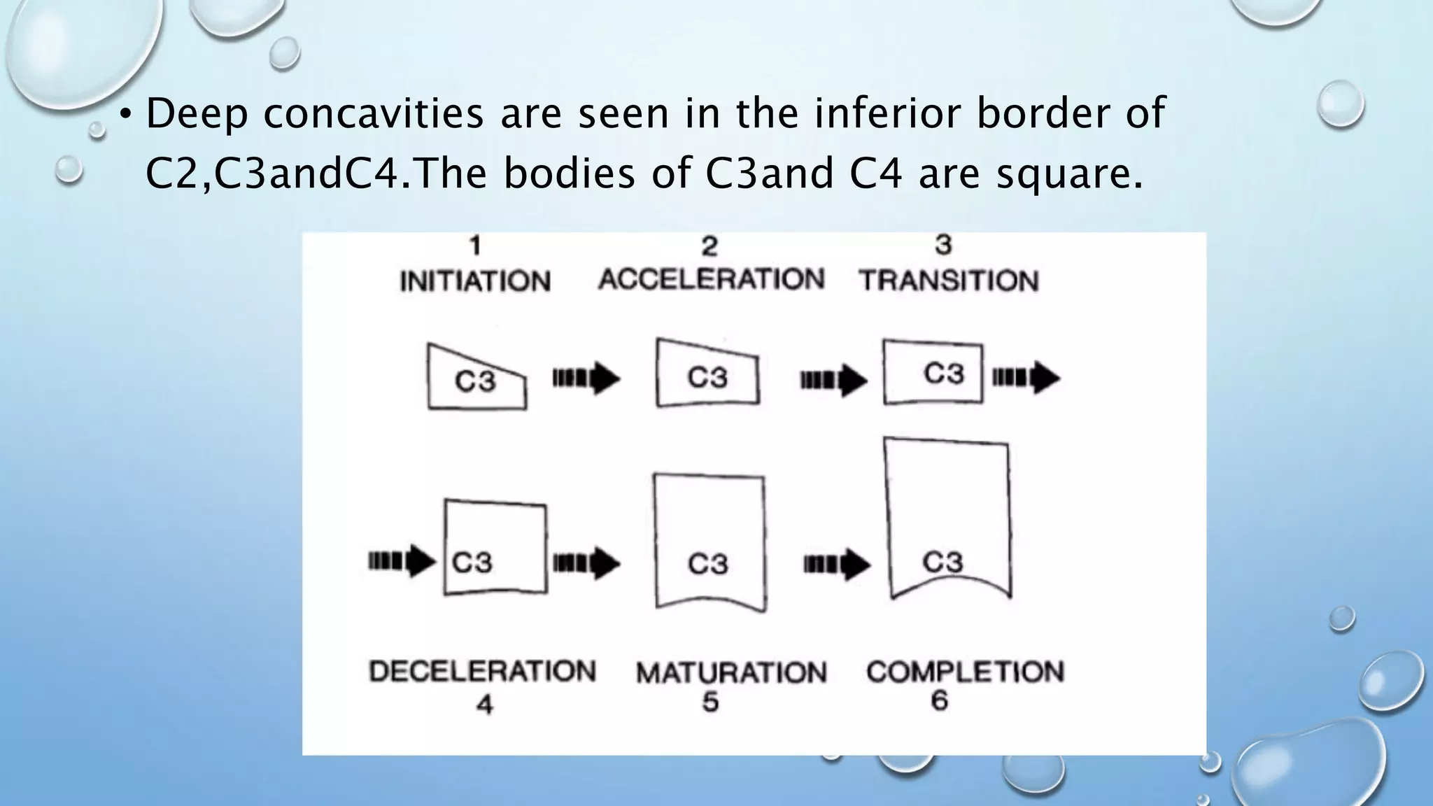 • Deep concavities are seen in the inferior border of
C2,C3andC4.The bodies of C3and C4 are square.
 